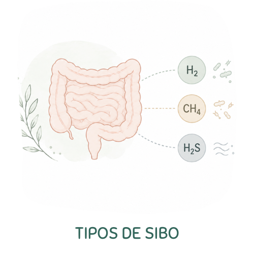 Tipos de SIBO_AVIVIR Tipos de SIBO